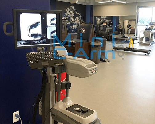 Orthoscan Mobile DI Mini C arm Tennessee Titans | Minicarm.com