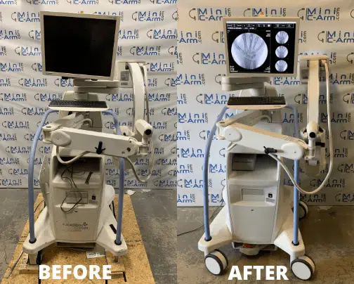 Hologic InSight 2 Mini C-Arm Before and After Refurbishment | Minicarm.com