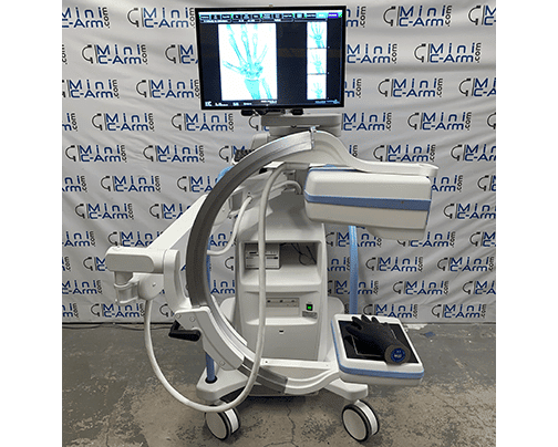 Hologic InSight FD was designed to be a compact, flexible system with a 120-degree range of motion| Hand scanning | Minicarm.com